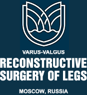 Varus-valgus reconstructive  surgery of legs. Hospital “Medica Mente” Moscow, Russia